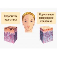 Коллаген SPORTSMAN'S  Collagen - 300g